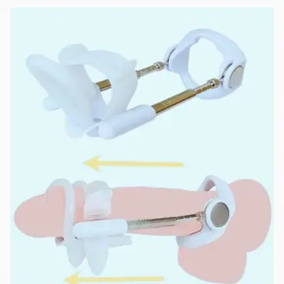Penis Extender Kit for Men – Adjustable Traction Device for Length, Girth & Curvature