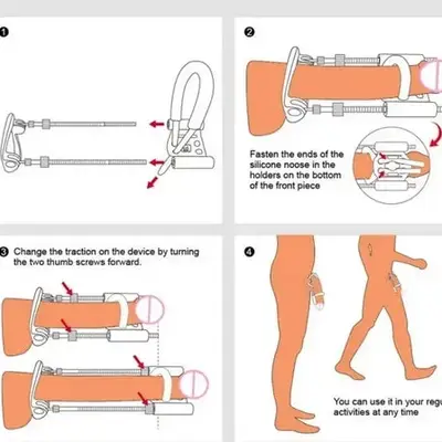 Penis Extender Kit for Men – Adjustable Traction Device for Length, Girth & Curvature